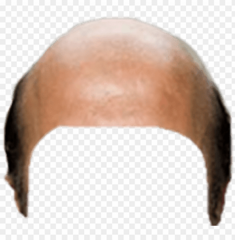 bald head snapchat filter - bald PNG Isolated Design Element with Clarity