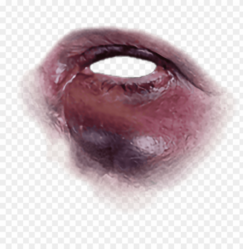 black eye bruise Isolated Character in Clear Transparent PNG
