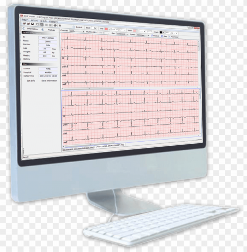 Bms-plus Bionet Ekgecgspirometer Software - Software PNG File With Alpha