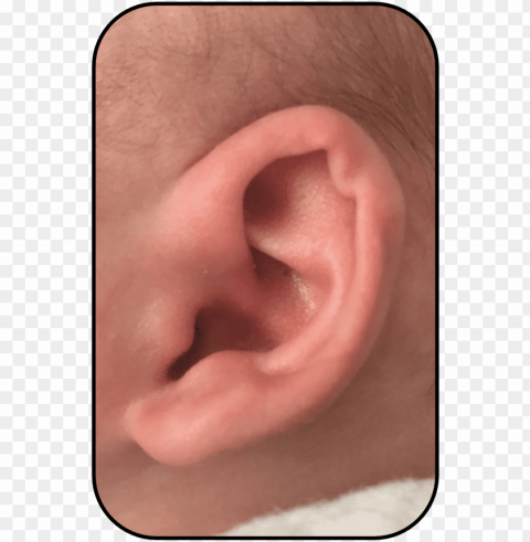 corrected baby ear usa parent story Clear Background PNG Isolated Subject PNG transparent with Clear Background ID fccf425f