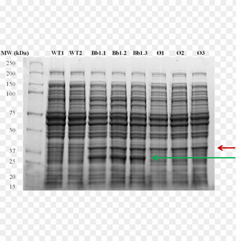 Figure - E Coli Total Protein Sds Page Free PNG Images With Transparent Background