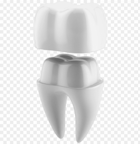 illustrated diagram of tooth getting a crown cap - 3d print dental crow HighQuality Transparent PNG Object Isolation