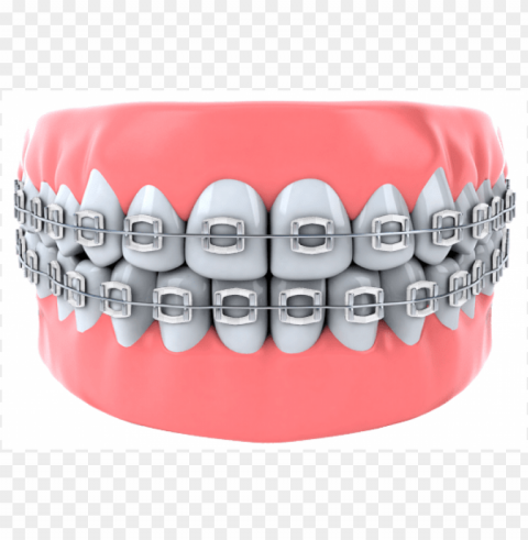 teeth - smoke braces color Isolated Illustration on Transparent PNG