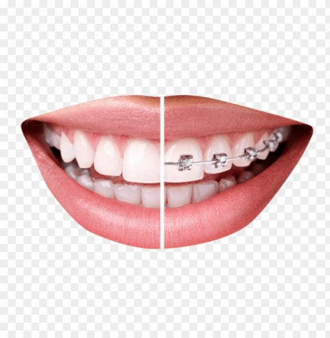 tooth PNG transparent photos vast variety