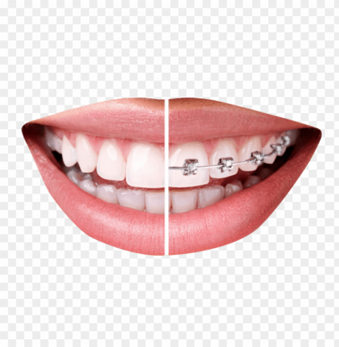 tooth PNG transparent photos vast variety PNG transparent with Clear Background ID 86c18c20