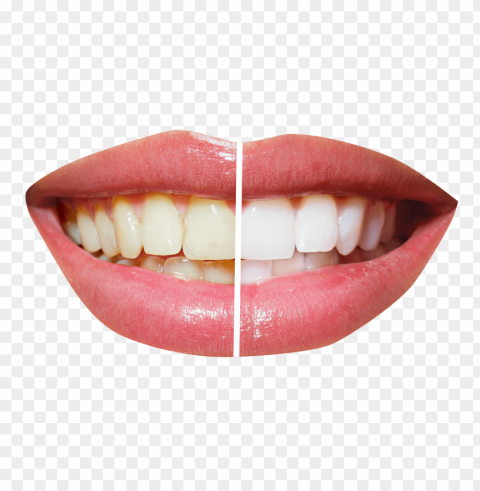tooth PNG with clear background set