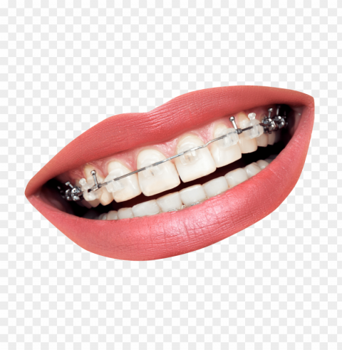 tooth PNG with Isolated Object