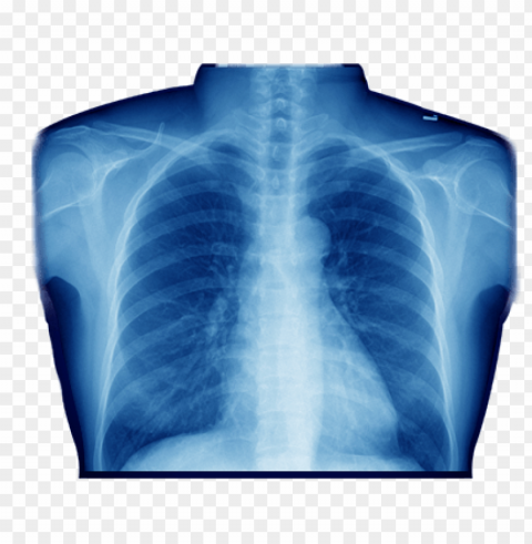 X-ray Of Chest PNG Isolated Object With Clear Transparency