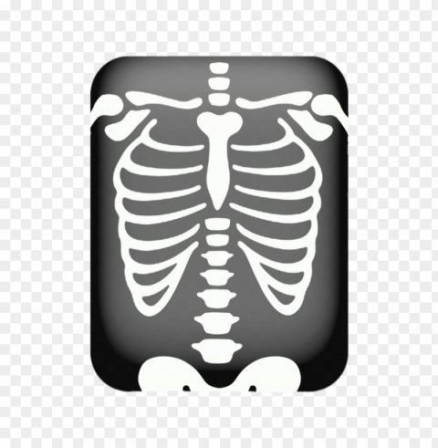 x-ray of chest PNG Isolated Subject on Transparent Background