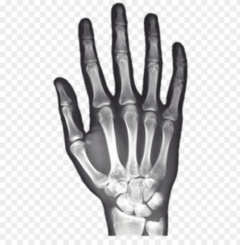 x-ray of hand PNG no background free