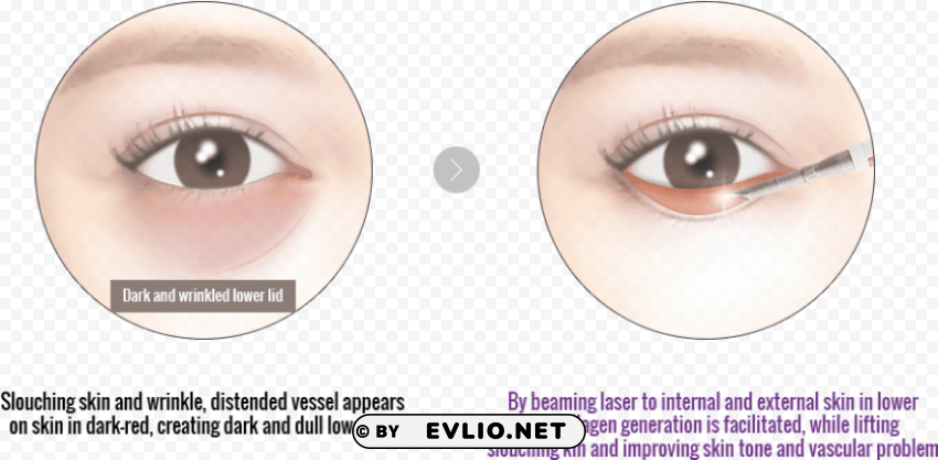 eyelash extensions Isolated Subject on HighQuality Transparent PNG