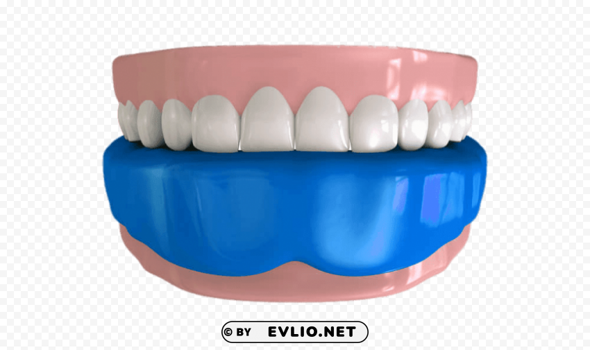 mouthguard on lower teeth illustration PNG for digital design