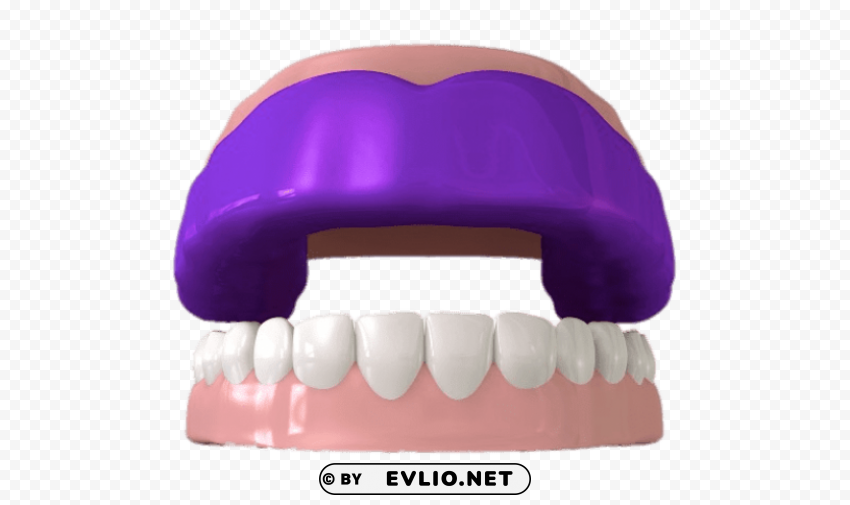 mouthguard on top teeth illustration PNG for educational use