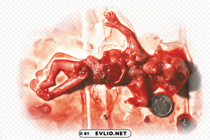 not your body abortion meme Transparent PNG images extensive variety