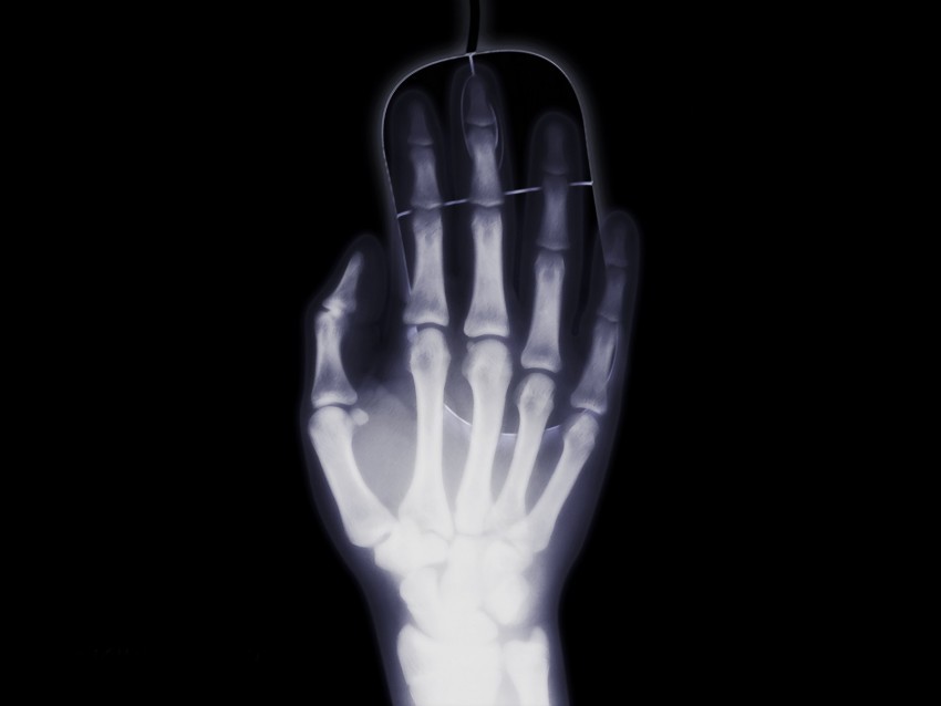 arm x-ray bone computer mouse PNG Isolated Object with Clear Transparency